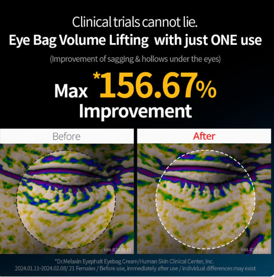 Dr Melaxin - Eyephalt Eyecream